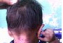 Comunidades exigen suspensión inmediata de aspersiones con glifosato por afectaciones a niñas y niños