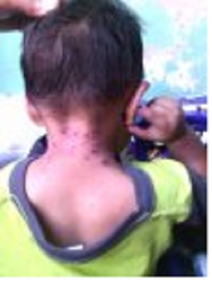Niños_Glifosato