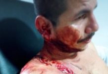 Policía atropelló a líderes campesinos del Putumayo